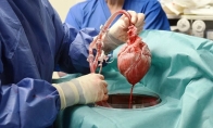 人类首次成功为患者移植猪心脏 术后病人情况良好